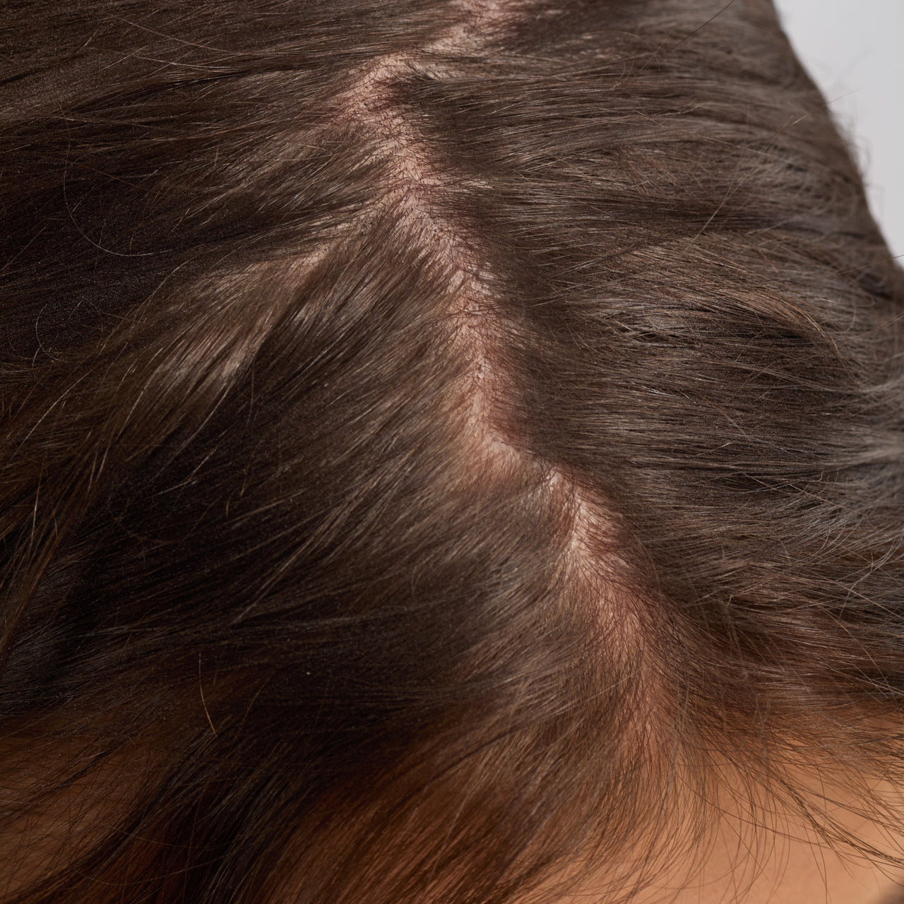 Strengthening Rosemary and Biotin Scalp and Hair Oil 3 Pack - Signature Selection